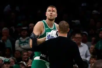 Kristaps Porzingis head split open