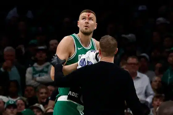Kristaps Porzingis head split open